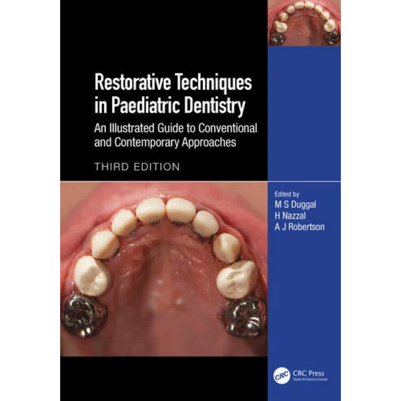 Restorative Techniques in Paediatric Dentistry An Illustrated Guide to Conventional and Contemporary Approaches, 3rd Edition