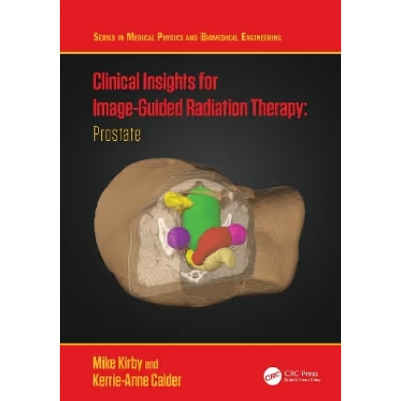 Clinical Insights for Image-Guided Radiotherapy Prostate