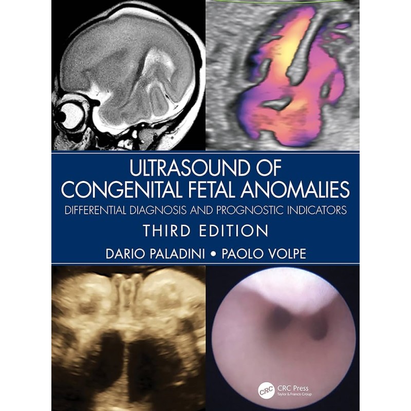 Ultrasound of Congenital Fetal Anomalies. Differential Diagnosis and Prognostic Indicators 3rd Edition