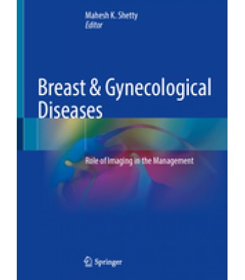 Breast & Gynecological Diseases, Role of Imaging in the Management 