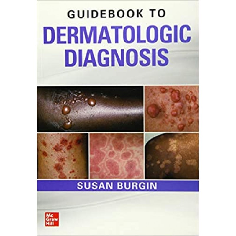 Guidebook to Dermatologic Diagnosis, 1st Edition