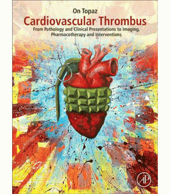 Cardiovascular Thrombus: From Pathology and Clinical Presentations to Imaging, Pharmacotherapy and Interventions