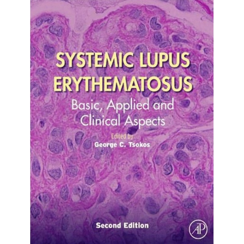 Systemic Lupus Erythematosus 2E: Basic, Applied and Clinical Aspects