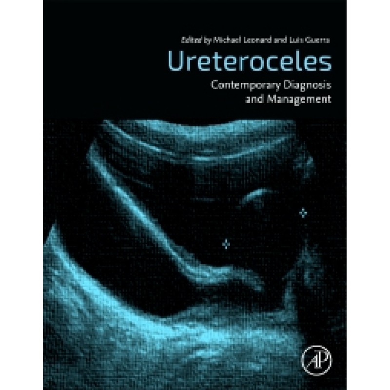 Ureteroceles - Contemporary Diagnosis and Management