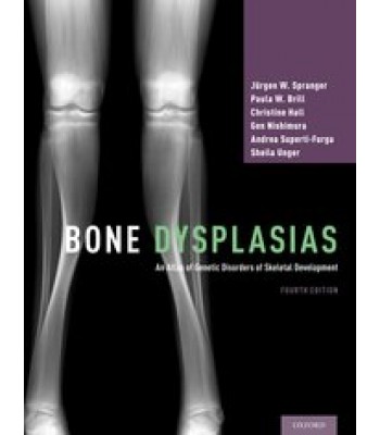Bone Dysplasias - An Atlas of Genetic Disorders of Skeletal Development