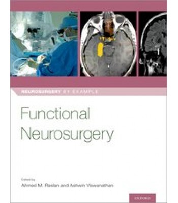 Functional Neurosurgery