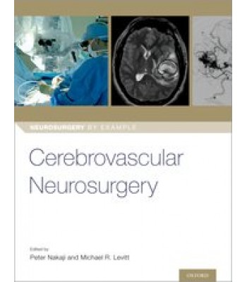 Cerebrovascular Neurosurgery