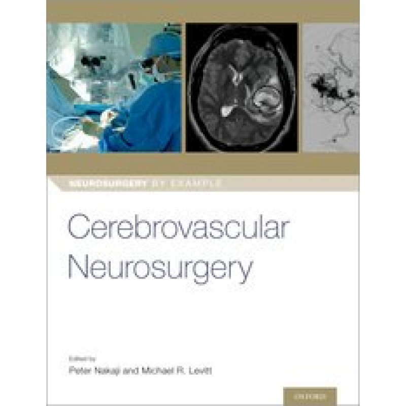 Cerebrovascular Neurosurgery