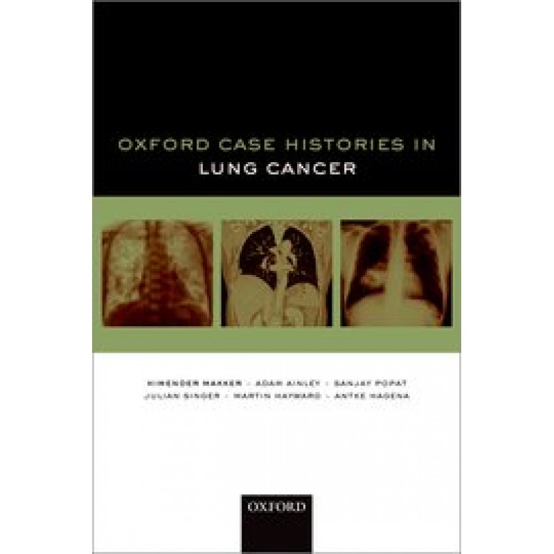 Oxford Case Histories in Lung Cancer