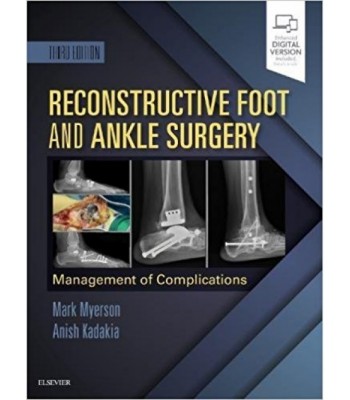 Reconstructive Foot and Ankle Surgery: Management of Complications , 3E