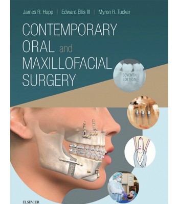 Contemporary Oral and Maxillofacial Surgery, 7th Edition