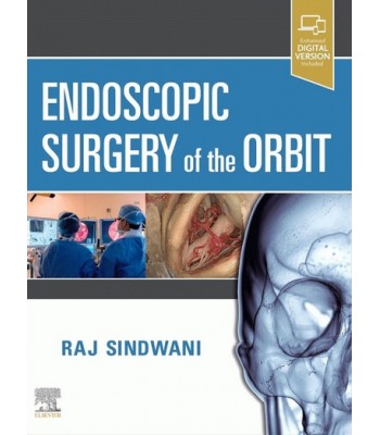 Endoscopic Surgery of the Orbit