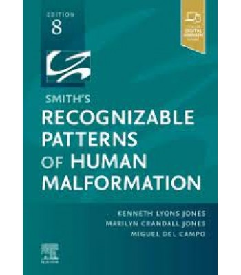 Smith's Recognizable Patterns of Human Malformation, 8E