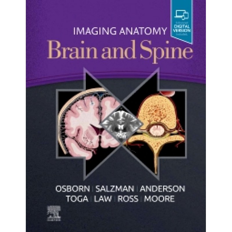 Imaging Anatomy Brain and Spine
