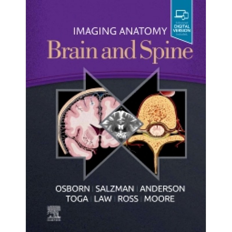 Imaging Anatomy Brain and Spine