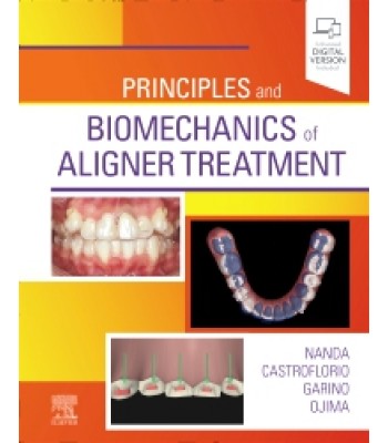 Principles and Biomechanics of Aligner Treatment