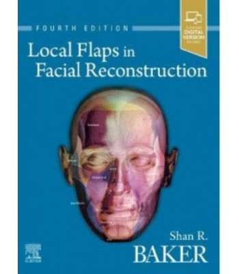 Local Flaps in Facial Reconstruction, 4E
