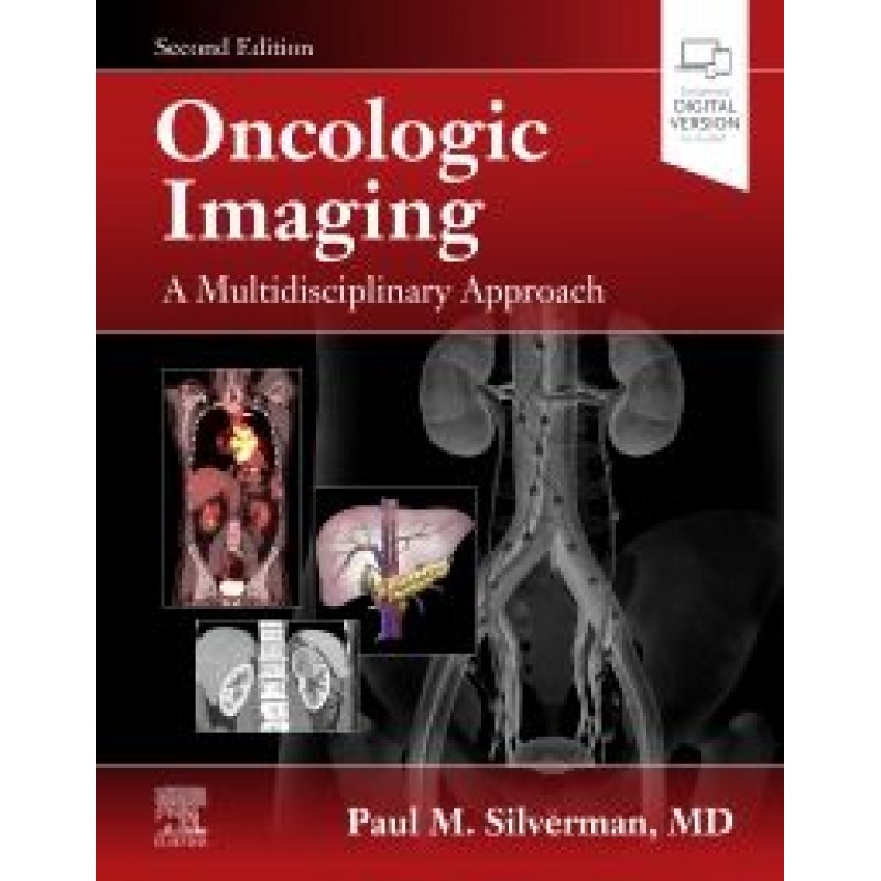 Oncologic Imaging: A Multidisciplinary Approach, 2E