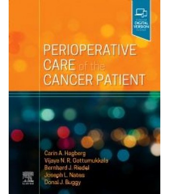 Perioperative Care of the Cancer Patient 