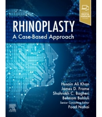 Rhinoplasty a Case-based approach 