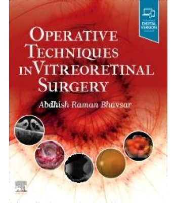 Operative Techniques in Vitreoretinal Surgery 