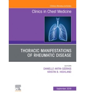 Thoracic Manifestations of Rheumatic Disease, An Issue of Clinics in Chest Medicine , Volume 40-3