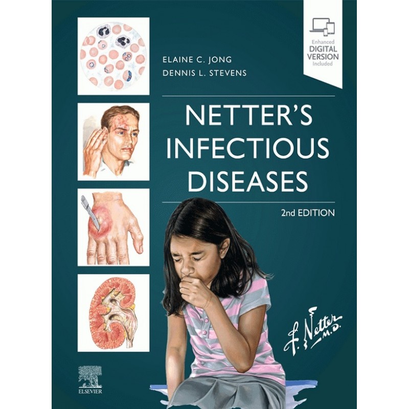 Netter's Infectious Diseases 2E