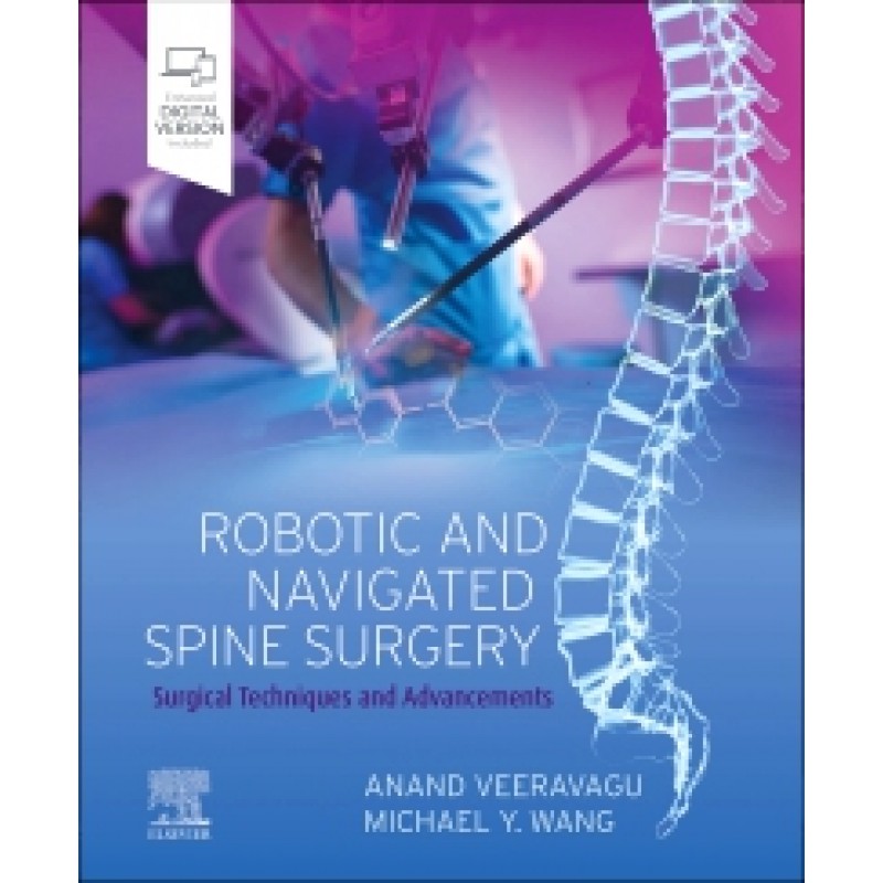 Robotic and Navigated Spine Surgery Surgical Techniques and Advancements 
