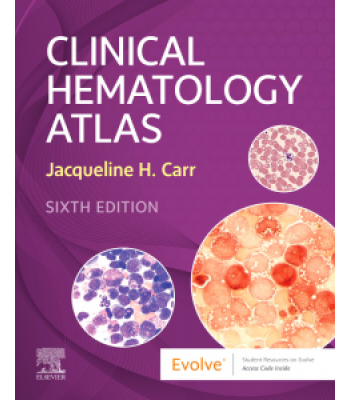 Clinical Hematology Atlas, 6E