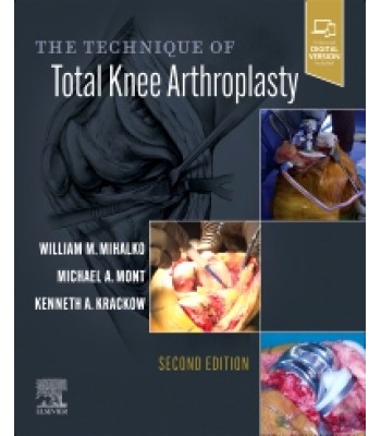 The Technique of Total Knee Arthroplasty, 2Ε 