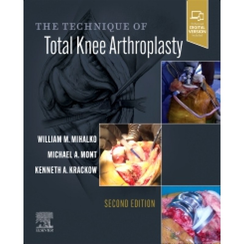The Technique of Total Knee Arthroplasty, 2Ε 