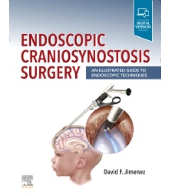 Endoscopic Craniosynostosis Surgery , An Illustrated Guide to Endoscopic Techniques 