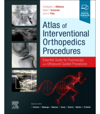 Atlas of Interventional Orthopedics Procedures Essential Guide for Fluoroscopy and Ultrasound Guided Procedures 9