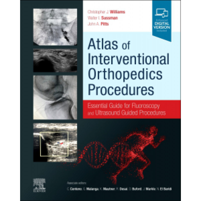 Atlas of Interventional Orthopedics Procedures / Essential Guide for Fluoroscopy and Ultrasound Guided Procedures 