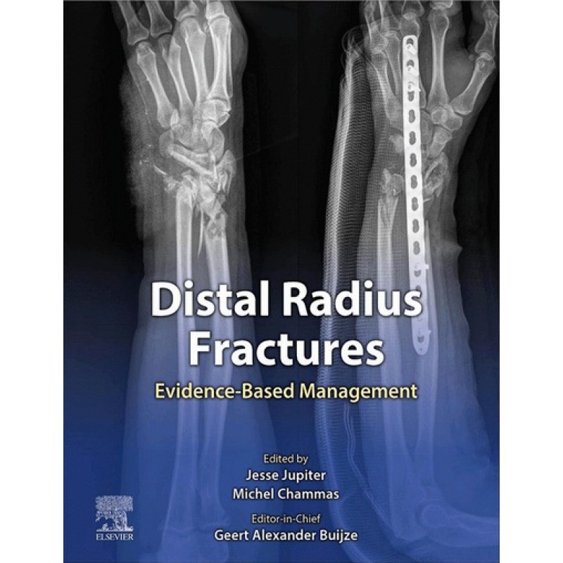 Distal Radius Fractures Evidence-Based Management