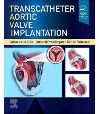 Transcatheter Aortic Valve Implantation