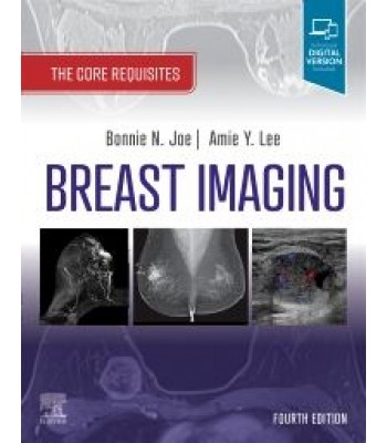 Breast Imaging, 4E The Core Requisites