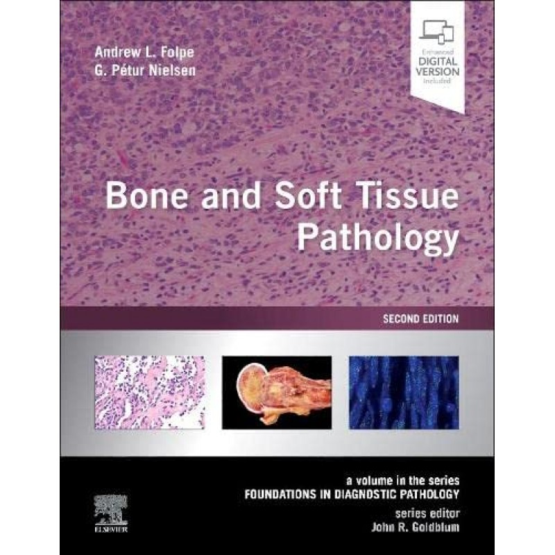 Bone and Soft Tissue Pathology, 2E (A Volume in the Series Foundations in Diagnostic Pathology)