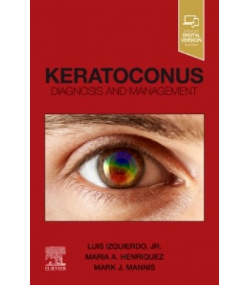 Keratoconus Diagnosis and Management 