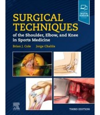 Surgical Techniques of the Shoulder, Elbow, and Knee in Sports Medicine, 3E
