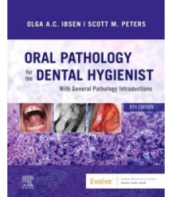 Oral Pathology for the Dental Hygienist, 8E