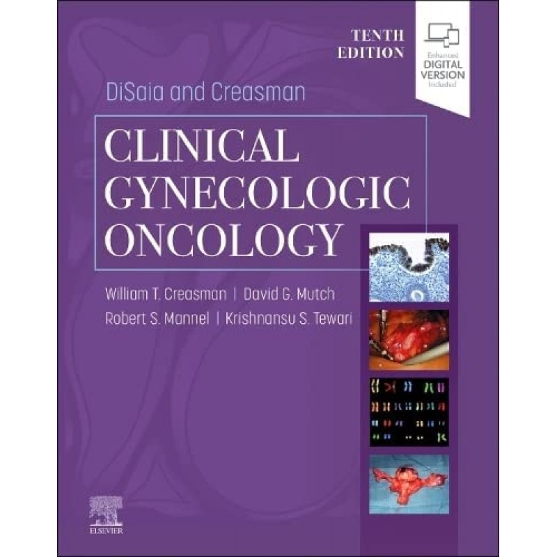 DiSaia and Creasman Clinical Gynecologic Oncology, 10E 