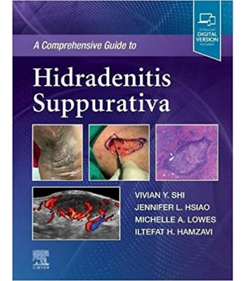 A Comprehensive Guide to Hidradenitis Suppurativa