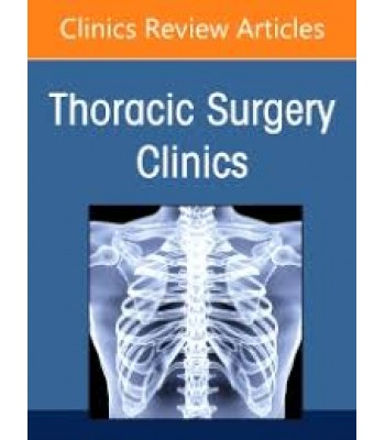 Thoracic Outlet Syndrome, An Issue of Thoracic Surgery Clinics, Volume 31-1