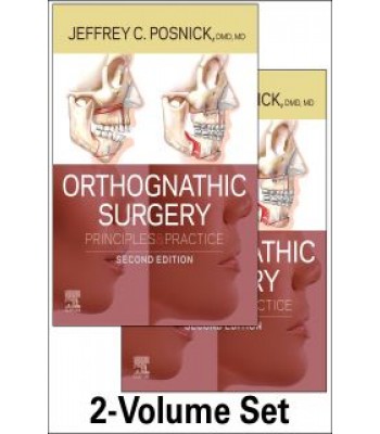 Orthognathic Surgery - 2 Volume Set, 2E , Principles and Practice