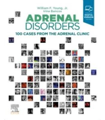 Adrenal Disorders 100 Cases from the Adrenal Clinic 