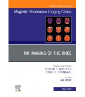 MR Imaging of The Knee, An Issue of Magnetic Resonance Imaging Clinics of North America, Volume 30-2 
