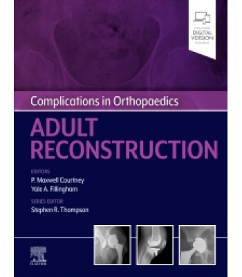 Complications in Orthopaedics: Adult Reconstruction 