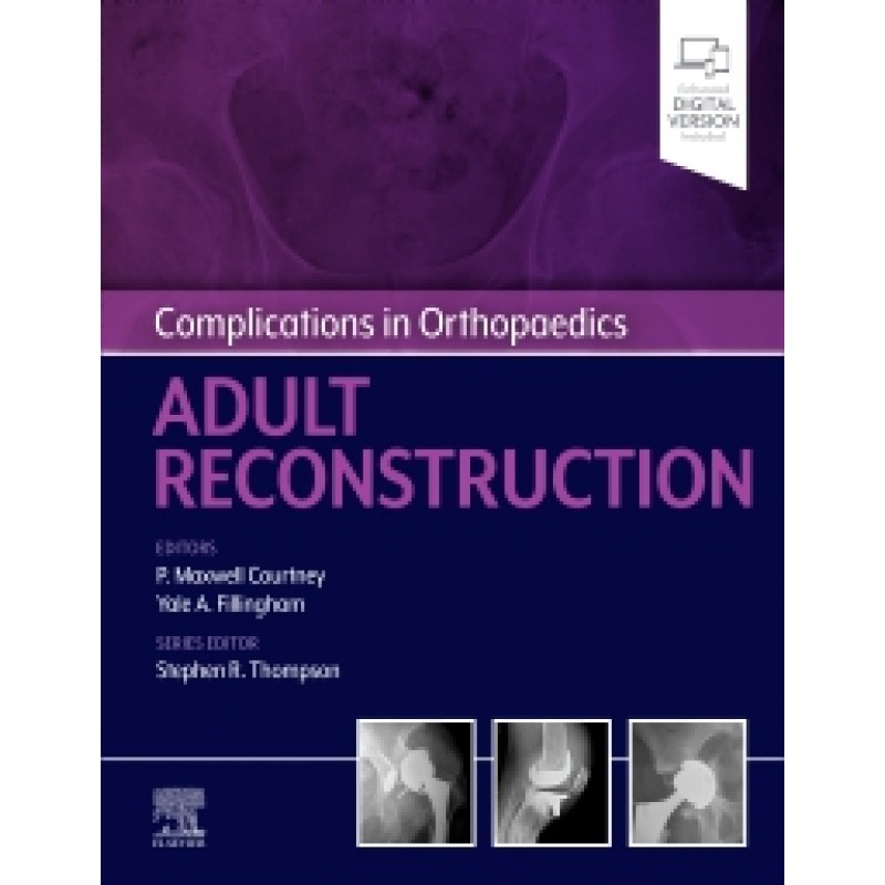 Complications in Orthopaedics: Adult Reconstruction