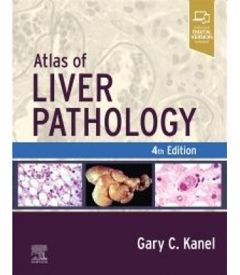 Atlas of Liver Pathology, 4th Edition